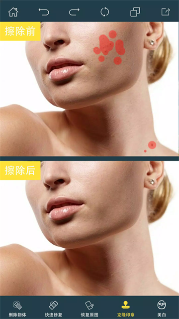 PhotoRetouch去水印修图应用截图第三张